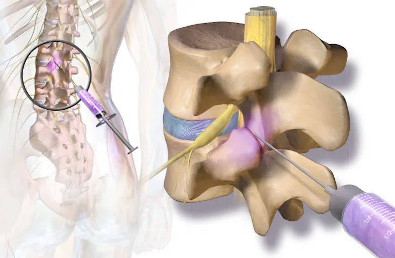 Νευροτροποποιηση