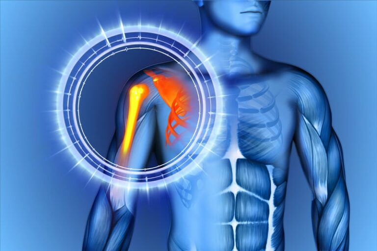 Αρθροσκόπηση ώμου